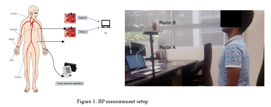 Non-Contact Blood Pressure Monitoring System using Dual mm-Wave Radar ...